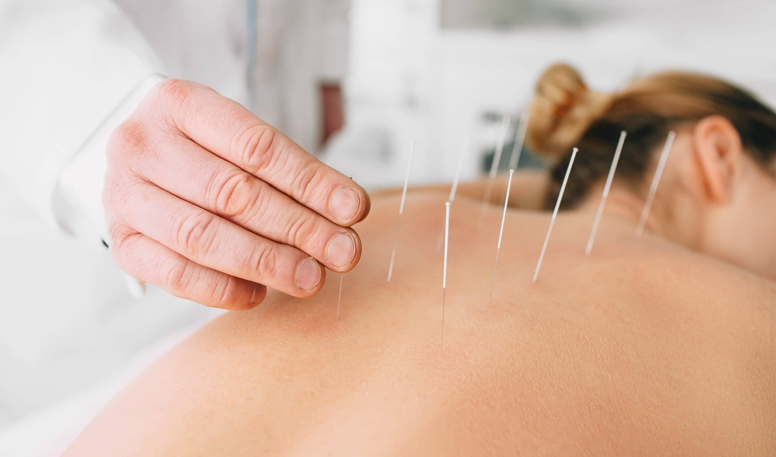acupuncture for addiction treatment